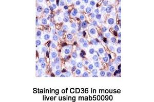 Image no. 1 for anti-CD36 (CD36) antibody (ABIN363244) (CD36 抗体)