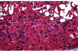 Human Testis: Formalin-Fixed, Paraffin-Embedded (FFPE) (CAPZB 抗体  (AA 192-272))