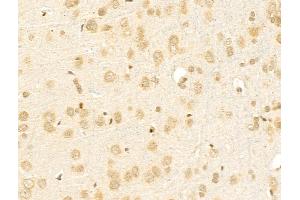 ABIN6256948 and ABIN6275299 at 1/100 staining Rat brain tissue by IHC-P. (NBPF1,9,10,12,14,15,16,20 (C-Term) 抗体)