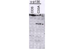 Western Blotting (WB) image for anti-Retinoblastoma-Like 2 (p130) (RBL2) (N-Term) antibody (ABIN264369)