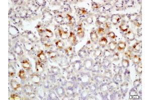 Formalin-fixed and paraffin embedded rat colon tissue labeled with Rabbit Anti-Leptin receptor(long) Polyclonal Antibody  at 1:200 followed by conjugation to the secondary antibody and DAB staining.