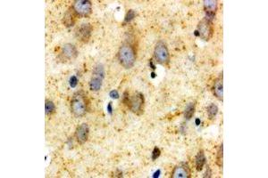 Immunohistochemical analysis of GLUR1 staining in human brain formalin fixed paraffin embedded tissue section.