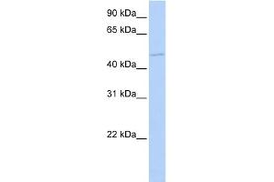WB Suggested Anti-TGIF1 Antibody Titration:  0. (TGIF1 抗体  (C-Term))