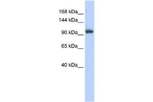 Western Blotting (WB) image for anti-Ring Finger Protein 31 (RNF31) antibody (ABIN2458723) (RNF31 抗体)