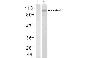 Western blot analysis of extracts from SW626 cell usingα-catenin (Ab-177) Antibody (E021521). (CTNNA1 抗体)