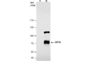 IP Image Optineurin antibody immunoprecipitates Optineurin protein in IP experiments.