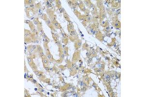 Immunohistochemistry of paraffin-embedded human gastric using STX7 antibody at dilution of 1:100 (x40 lens). (Syntaxin 7 抗体)