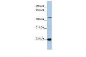Image no. 1 for anti-Zinc Finger Protein 581 (ZNF581) (AA 72-121) antibody (ABIN6737781) (ZNF581 抗体  (AA 72-121))