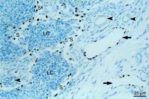 Immunohistochemical detection of endogenous PROX1 (paraffin sections) in equine mandibular lymph nodeusing anti-PROX1, pAb (dilution 1:200) , counterstained with toluidine blue. (PROX1 抗体  (AA 547-737))