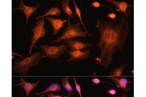 Immunofluorescence analysis of U-251MG cells using TUBB3 Polyclonal Antibody at dilution of 1:100. (TUBB3 抗体)