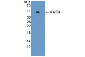 Western blot analysis of recombinant Mouse GRPR. (GRPR 抗体  (AA 1-116))
