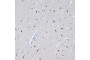 Immunohistochemistry (IHC) image for anti-Estrogen-Related Receptor alpha (ESRRA) (AA 1-423) antibody (ABIN6140306)