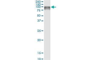 Immunoprecipitation of SILV transfected lysate using anti-SILV MaxPab rabbit polyclonal antibody and Protein A Magnetic Bead , and immunoblotted with SILV purified MaxPab mouse polyclonal antibody (B01P) . (Melanoma gp100 抗体  (AA 1-661))