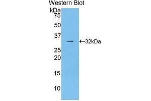 Detection of Recombinant CD2AP, Rat using Polyclonal Antibody to CD2 Associated Protein (CD2AP) (CD2AP 抗体  (AA 368-623))