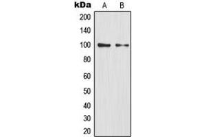 Western blot analysis of NF-kappaB p100 expression in HEK293T (A), mouse liver (B) whole cell lysates. (NFKB2 抗体  (C-Term))