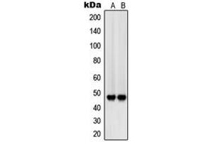 Western blot analysis of CD172b expression in A375 (A), A549 (B) whole cell lysates. (SIRPB1 抗体  (Center))