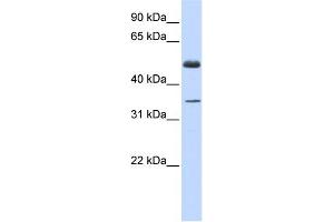 WB Suggested Anti-ZNF223 Antibody Titration:  0. (ZNF223 抗体  (Middle Region))