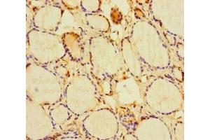 Immunohistochemistry of paraffin-embedded human thyroid tissue using ABIN7154596 at dilution of 1:100 (RIT1 抗体  (AA 1-219))