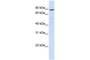ATP6V0A2 antibody used at 1 ug/ml to detect target protein. (ATP6V0A2 抗体  (N-Term))