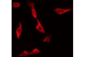 Immunofluorescence (fixed cells) (IF/ICC) image for anti-Cytochrome P450, Family 1, Subfamily A, Polypeptide 1/2 (CYP1A1/2) antibody (ABIN6261191)
