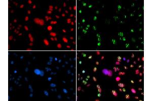 Immunofluorescence analysis of GFP-RNF168 transgenic U2OS cells using RAG2 antibody (ABIN5973278). (RAG2 抗体)