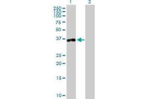 Western Blot analysis of TTC1 expression in transfected 293T cell line by TTC1 MaxPab polyclonal antibody. (TTC1 抗体  (AA 1-292))