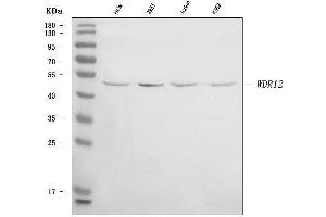 Western blot analysis of WDR12 using anti-WDR12 antibody (ABIN7602332).