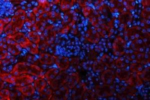 IF analysis of GLS using anti-GLS antibody (ABIN7601603).