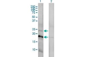 Western Blotting (WB) image for anti-Claudin 1 (CLDN1) (AA 1-211) antibody (ABIN563931)