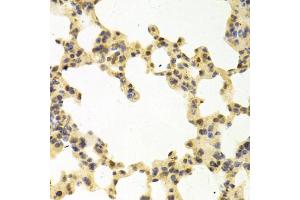 Immunohistochemistry of paraffin-embedded mouse lung using RANGAP1 antibody (ABIN5973116) at dilution of 1/100 (40x lens). (RANGAP1 抗体)