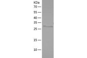 Western Blotting (WB) image for Galectin 3 (LGALS3) (AA 1-264) protein (His tag) (ABIN7123043) (Galectin 3 Protein (LGALS3) (AA 1-264) (His tag))