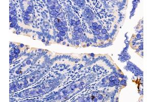 ABIN7094537 and ABIN7098586 at 1/100 staining Rat colorectal tissue by IHC-P. (FGF7 抗体  (Internal Region))