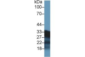 Western Blotting (WB) image for anti-Succinate Dehydrogenase Complex, Subunit B, Iron Sulfur (Ip) (SDHB) (AA 97-282) antibody (ABIN7441589)