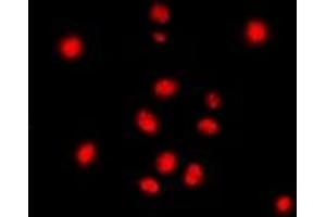 Immunofluorescent analysis of STAG3 staining in Jurkat cells. (STAG3 抗体  (C-Term))
