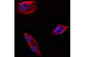 ABIN6258683 and ABIN6274711 staining Hela by IF/ICC. (AGPAT4 抗体  (Internal Region))