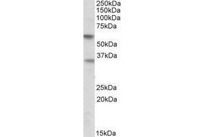 Western Blotting (WB) image for anti-Sialic Acid Binding Ig-Like Lectin 6 (SIGLEC6) (Internal Region) antibody (ABIN2464895) (SIGLEC6 抗体  (Internal Region))