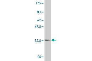 Western Blot detection against Immunogen (34. (ZIC1 抗体  (AA 139-212))