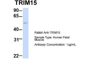 Host: Rabbit  Target Name: TRIM15  Sample Tissue: Human Fetal Muscle  Antibody Dilution: 1. (TRIM15 抗体  (Middle Region))