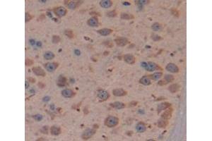 IHC-P analysis of Mouse Tissue, with DAB staining. (DIXDC1 抗体  (AA 513-711))