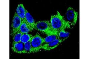 Confocal immunofluorescent analysis of ACADM antibody with HepG2 cells followed by Alexa Fluor 488-conjugated goat anti-rabbit lgG (green). (Medium-Chain Specific Acyl-CoA Dehydrogenase, Mitochondrial (MCAD) (AA 189-217) 抗体)