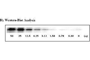 Image no. 6 for Signal Transducer and Activator of Transcription 3 (Acute-Phase Response Factor) (STAT3) ELISA Kit (ABIN1981816)