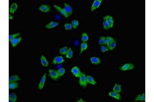 Immunofluorescent analysis of HepG2 cells using ABIN7169976 at dilution of 1:100 and Alexa Fluor 488-congugated AffiniPure Goat Anti-Rabbit IgG(H+L) (SLC6A3 抗体  (AA 161-237))