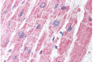 Human Heart (formalin-fixed, paraffin-embedded) stained with MDH1 antibody ABIN291679 at 5 ug/ml followed by biotinylated secondary antibody, alkaline phosphatase-streptavidin and chromogen. (MDH1 抗体)