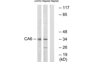 Western blot analysis of extracts from LOVO cells and HepG2 cells, using CA6 antibody. (CA6 抗体  (C-Term))