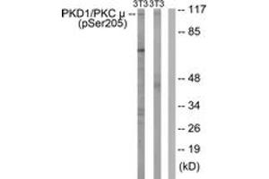 Western blot analysis of extracts from NIH-3T3 cells treated with Anisomycin 25ug/ml 30', using PKD1/PKC mu (Phospho-Ser205) Antibody. (PKC mu 抗体  (pSer205))