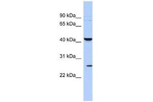 KCNMB4 antibody used at 1 ug/ml to detect target protein. (KCNMB4 抗体  (Middle Region))