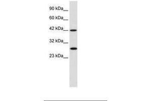 Image no. 1 for anti-Proteasome (Prosome, Macropain) 26S Subunit, Non-ATPase, 4 (Psmd4) (AA 92-141) antibody (ABIN202377) (PSMD4/ASF 抗体  (AA 92-141))