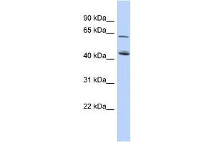 WB Suggested Anti-C5orf33 Antibody Titration: 0. (NADK2 抗体  (Middle Region))
