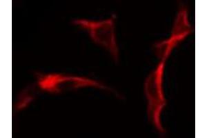 ABIN6274628 staining Hela cells by IF/ICC. (COL25A1 抗体  (N-Term))