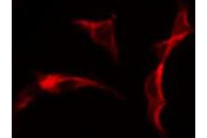 Immunofluorescence (fixed cells) (IF/ICC) image for anti-Collagen, Type XXV, alpha 1 (COL25A1) (N-Term) antibody (ABIN6257062)